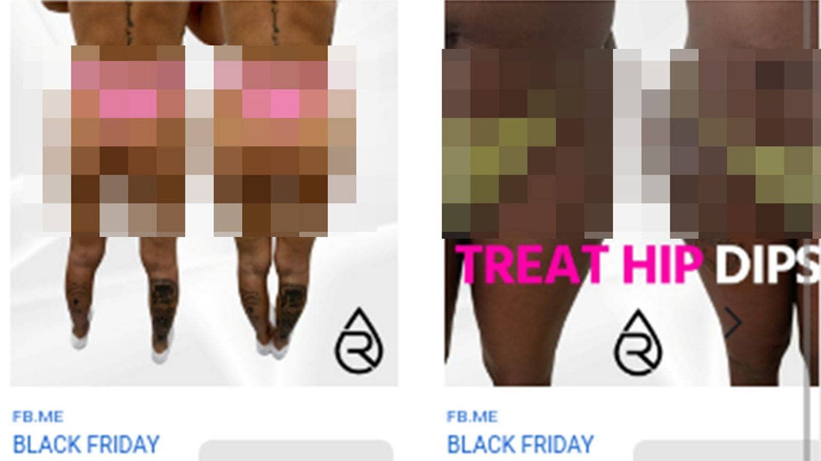 Brazilian butt lift adverts banned in the UK – here's why